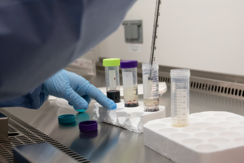 Vitalant Launches National Service Hubs to Expand Patient Access to Cell and Gene Therapies thumbnail